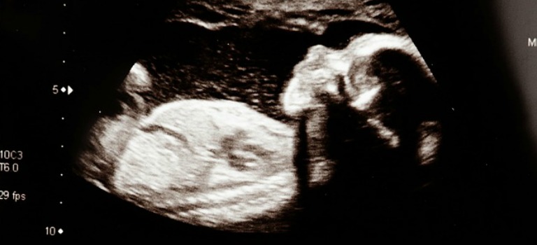 Blogparade: Und plötzlich schwanger